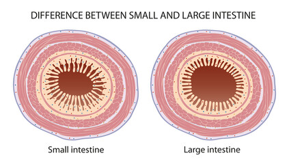Difference Between Small and Large Intestine - obrazy, fototapety, plakaty