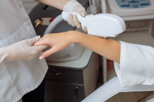 Laser hair removal of hand hair. Doctor cosmetologist removes the hair on his hands with the help of SHR laser. cosmetology and spa
