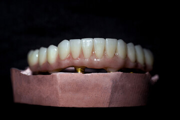 Zirconia denture