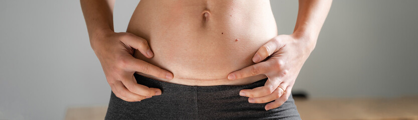 Woman abdomen with cesarean scar. Home candid lifestyle. C section surgery for pregnant woman....