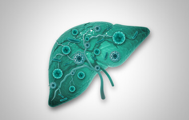 Medically accurate illustration of diseased liver. Virus infected liver. 3d illustration