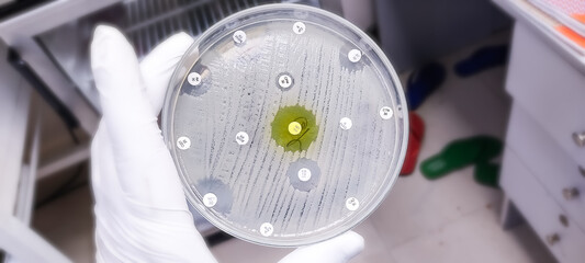 Antimicrobial susceptibility testing in culture plate. Drug sensitivity test, disk drug, antibiotic...