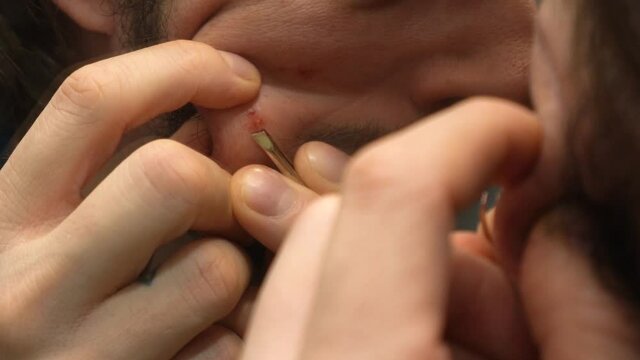 Close up on an adult man picking up his face to remove a hair until bleeding, bathroom mirror