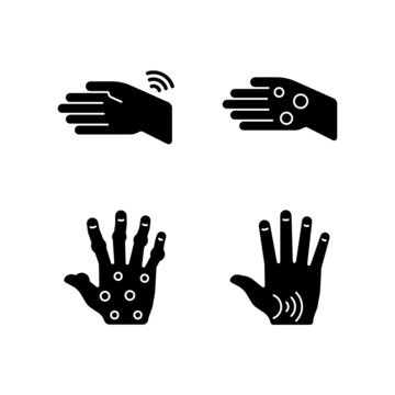 Arthritis In Hands Black Glyph Icons Set On White Space. Wrists Rheumatism. Fingers Deformity. Rheumatoid Nodules. Osteoarthritis In Thumb. Silhouette Symbols. Vector Isolated Illustration