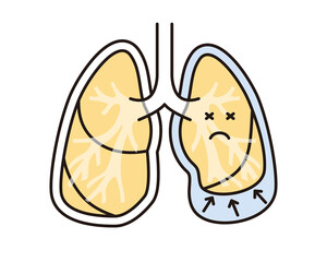 シンプル　イラスト　胸水の肺