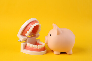 Plastic model of a human jaw with piggy bank on yellow background © splitov27