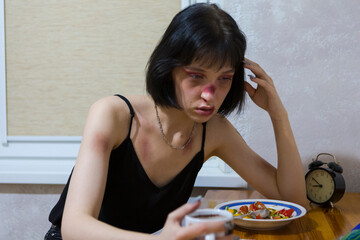 Sad Caucasian Female as a Victim of Domestic Violence and Abuse With Multiple Bruises Having...