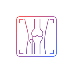 Arthritis x ray gradient linear vector icon. Joint deformity depiction. Osteoarthritis diagnosis. Medical imaging. Thin line color symbol. Modern style pictogram. Vector isolated outline drawing