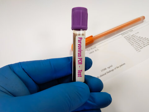Scientist holding blood sample tube for Parvovirus PCR test at medical laboratory. To diagnosis parvovirus RNA, genotype