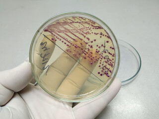 Bacteria colony of Escherichia coli (E.coli) in culture media plate