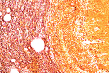 Cerebellum, Thalamus, Medulla oblongata, Spinal cord and Motor Neuron human under the microscope in...