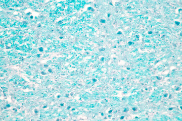 Cerebellum, Thalamus, Medulla oblongata, Spinal cord and Motor Neuron human under the microscope in Lab.
