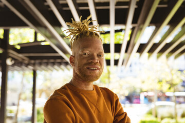Portrait of smiling albino african american man with dreadlocks looking at camera