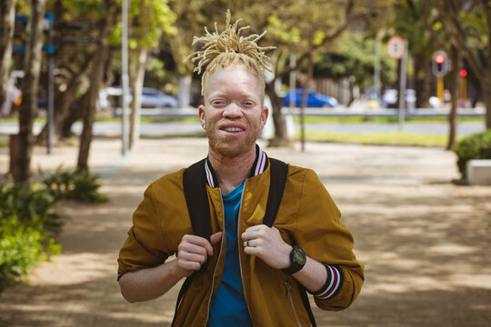 Portrait of smiling albino african american man with dreadlocks looking at camera