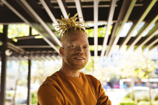 Portrait of smiling albino african american man with dreadlocks looking at camera