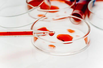 Blood test analysis with Petri dish close up.Blood coronavirus test.Virus vaccine development.Medical laboratory.Test tube,Petri dish with blood on a white background.Concept of laboratory research.
