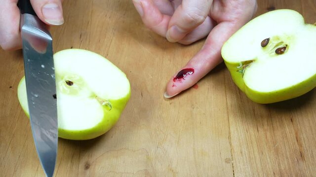 Woman cut her finger with a knife while cooking on the kitchen. Finger with blood, cooking accident.