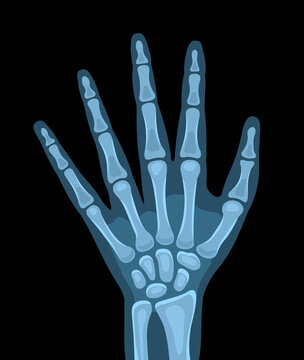 Vector illustration of x-ray picture of the human body, hand. Vector illustration
