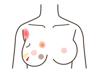 胸の病気のサイン