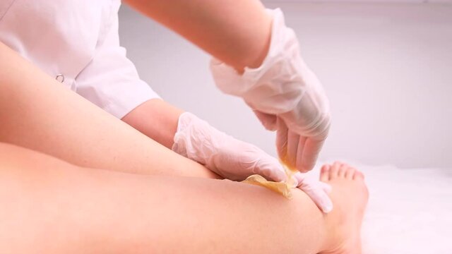 Cropped video of beautician hands in medical gloves doing the procedures for depilation of the woman legs with shugaring . Shugar paste