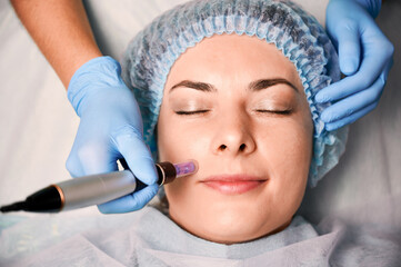Close up of beautician hands in sterile gloves using dermapen during skincare procedure. Young...