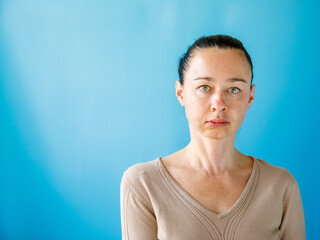 Teeth Problem. Gumboil, flux, bruise and swelling of cheek. Closeup Of Beautiful Sad Woman with...