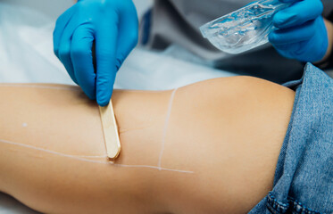 Application of contact transparent gel before the laser hair removal procedure. Skin care, cosmetic procedures.