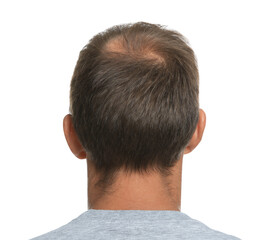 Obraz premium Man with hair loss problem on white background, back view