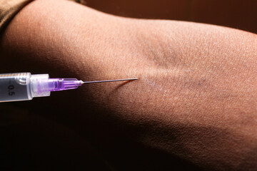 A doctor makes an injection into a vein. Intravenous drug administration. The concept of providing professional medical care