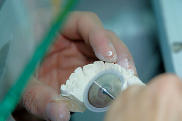Dental Technician.Close-up of a man working on creating a human jaw with teeth