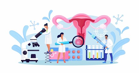 Cancer of cervix, papillomavirus. Tiny doctors examine uterus with magnifier to treat cervical cancer,  cauterize erosion, diagnosis papilloma. HPV vaccination. Gynecology, female disease. Vector  - obrazy, fototapety, plakaty