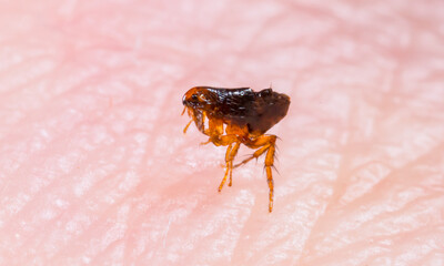 Flea on human skin close up. Extermination of parasites, insecticides, house disinfection.