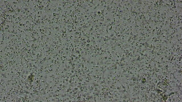 Human sperm 2000 times magnification form microscope.
