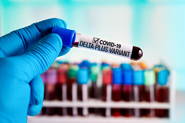 Doctor with a positive blood sample for the new variant detected of the coronavirus strain called DELTA PLUS. Technician holding tube of blood test identified with the label Covid-19 DELTA Plus Varian