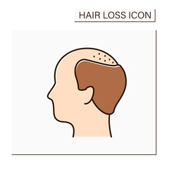 Hair loss color icon. Man loses hair. Male pattern baldness. Large bald area on frontal and central scalp. Alopecia concept. Isolated vector illustration