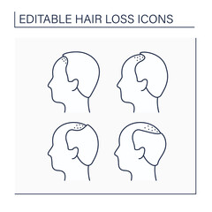 Hair loss line icons set. Classification for baldness in man. Treatment and care. Alopecia concept. Isolated vector illustration. Editable stroke