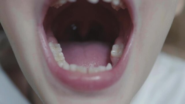 Cute school-age girl at an appointment with a doctor dentist, a jaw surgeon or an orthodontist. Child opens his mouth