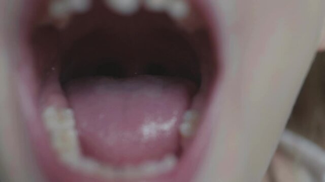 Opened mouth with focus on throat, tongue and milk teeth