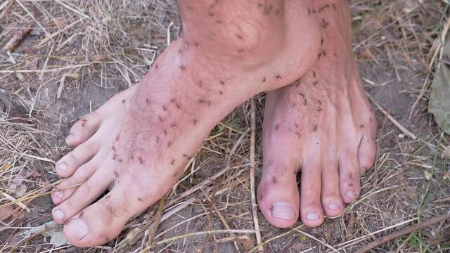 Army of Brown Ants is Crawling on Human Bare Legs Standing on Grass. Large number of ants of Formycin family attack, bites, runs on tourist hairy male feet. Camping outdoor. Summertime. 4K. Close up.