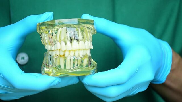 Close-up photo of implant dentistry it is a replacement for missing teeth by dentist hand.