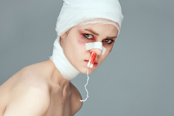 woman bruised face medicine treatment injury isolated background