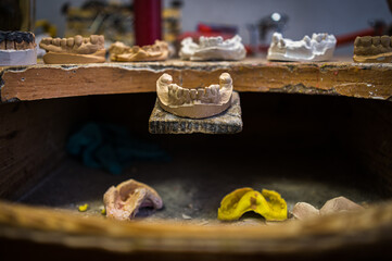 a copy of a human tooth with a dental technician