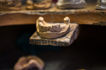 a copy of a human tooth with a dental technician