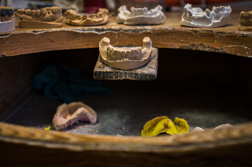 a copy of a human tooth with a dental technician