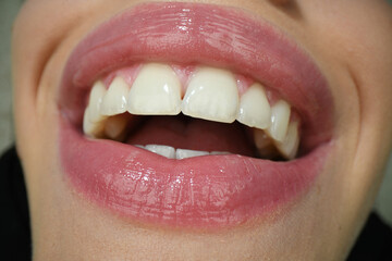 Smiling mouth. Dental care, healthy teeth and smile, white teeth in mouth. Closeup of smile with white healthy teeth.