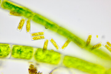 Microscopic view of a diatoms (Diatoma) and green algae filaments. Brightfield illumination.