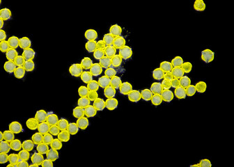 Microscopic view of a Spurge (Euphorbia sp.) pollen grains. Darkfield illumination.