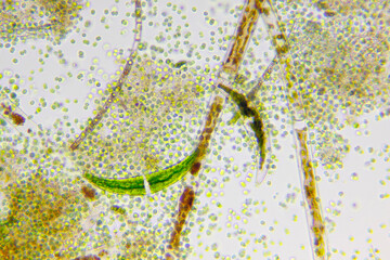 Microscopic view of different types of algae. Brightfield illumination.
