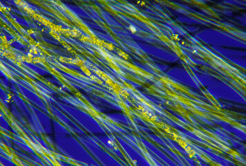 Microscopic view of a cyanobacteria (blue-green algae, Oscillatoria) filaments. Polarized light with crossed polarizers.