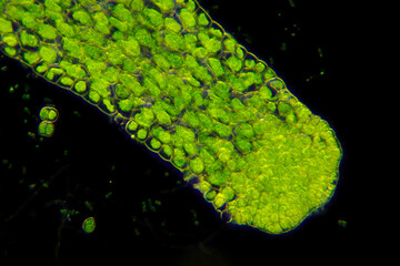 Microscopic view of Crystalwort (Riccia fluitans) thalli. Darkfield illumination.